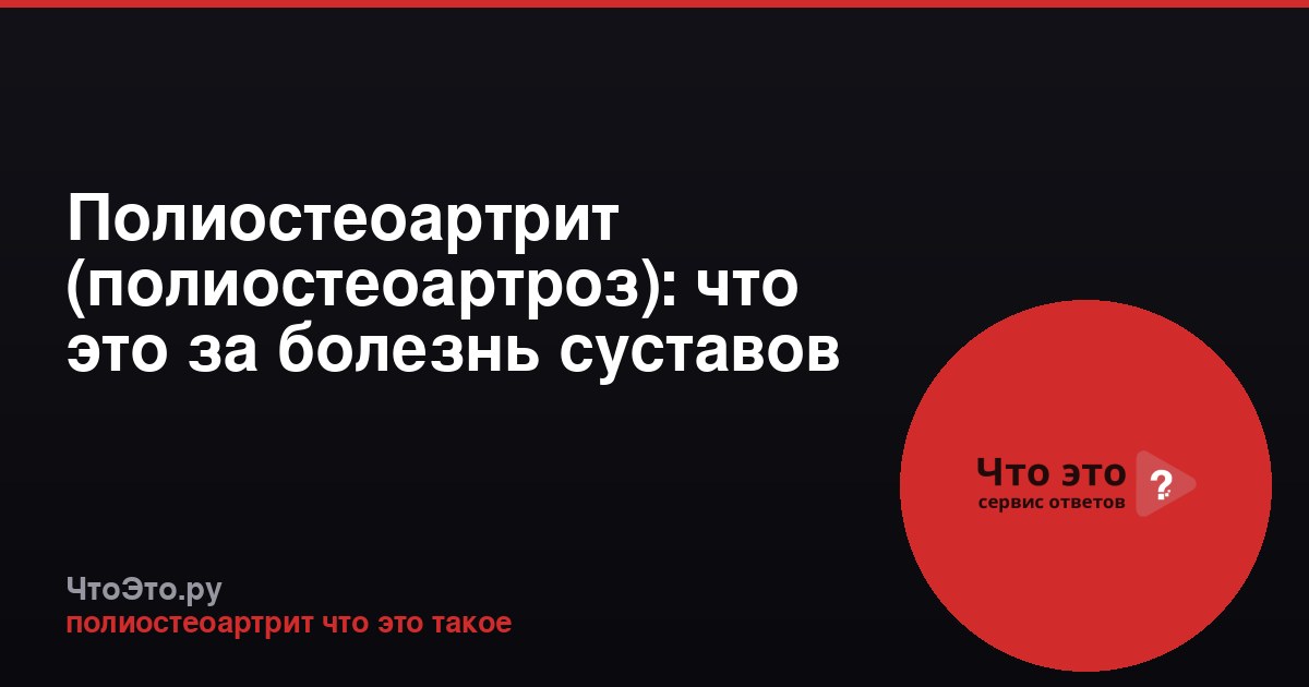 Полиостеоартрит (полиостеоартроз): что это за болезнь суставов