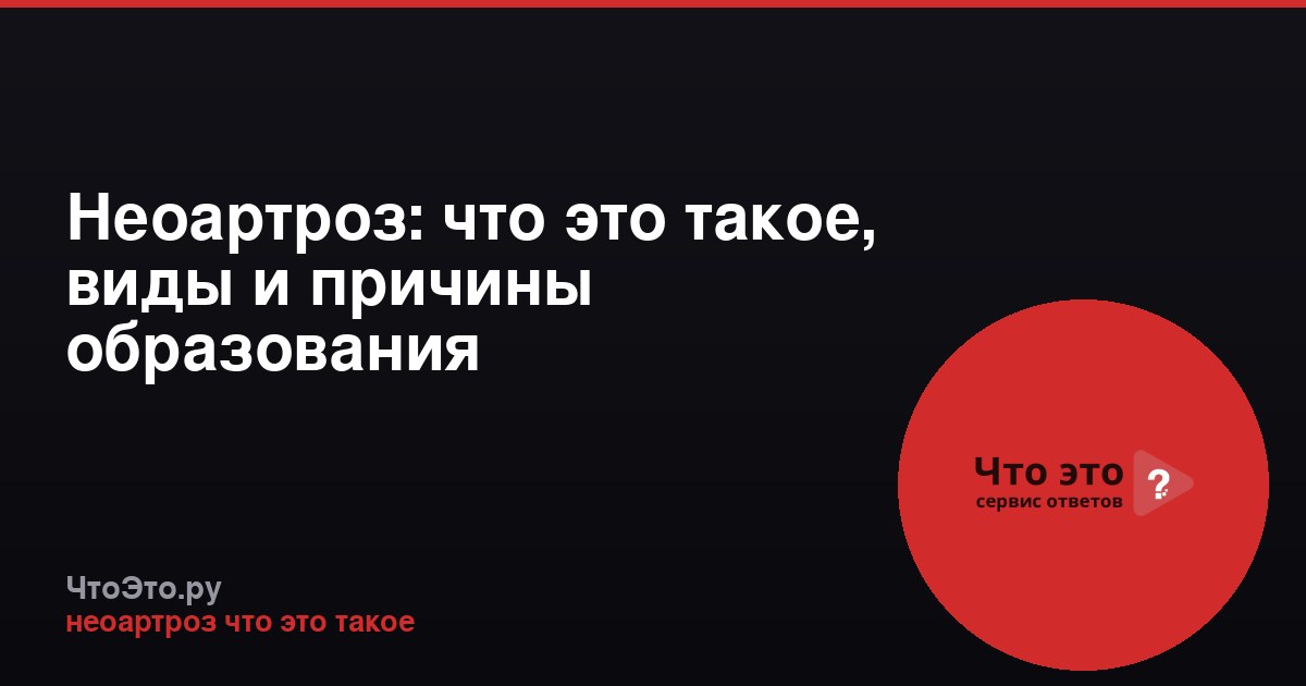 Неоартроз: что это такое, виды и причины образования