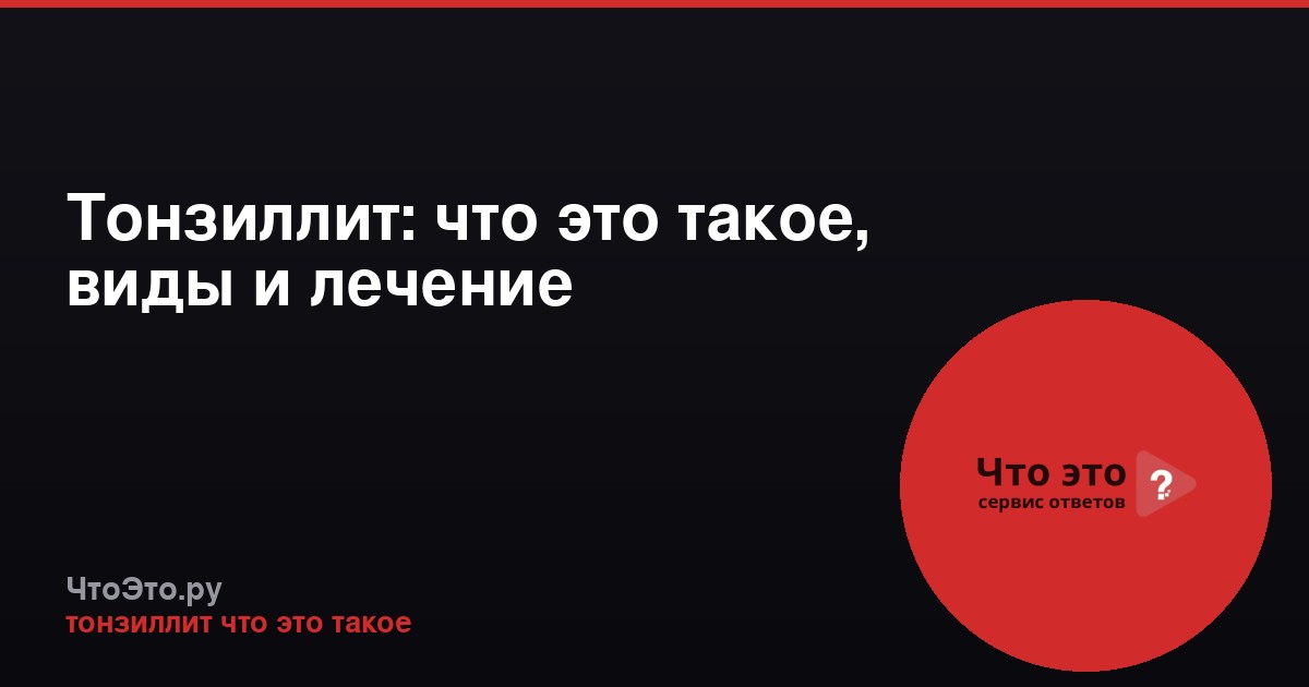Тонзиллит: что это такое, виды и лечение