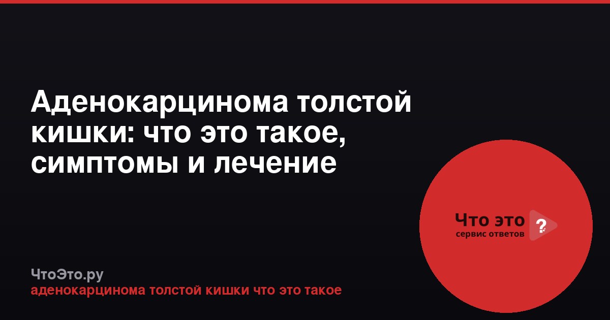 Аденокарцинома толстой кишки: что это такое, симптомы и лечение