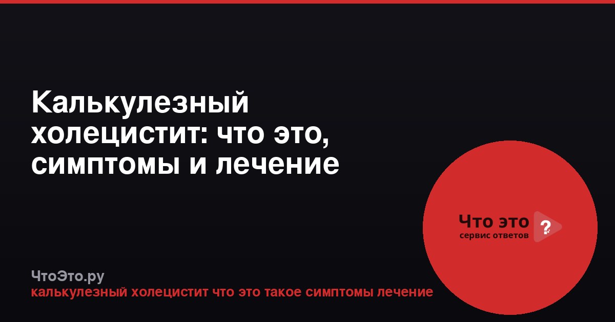 Калькулезный холецистит: что это, симптомы и лечение