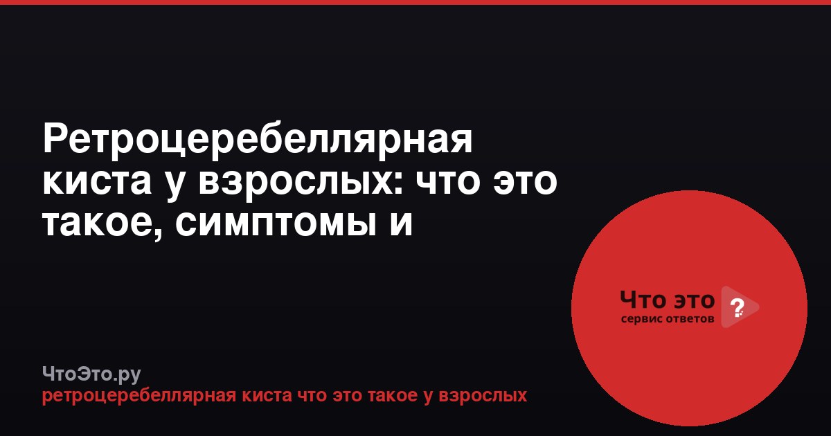 Ретроцеребеллярная киста у взрослых: что это такое, симптомы и лечение