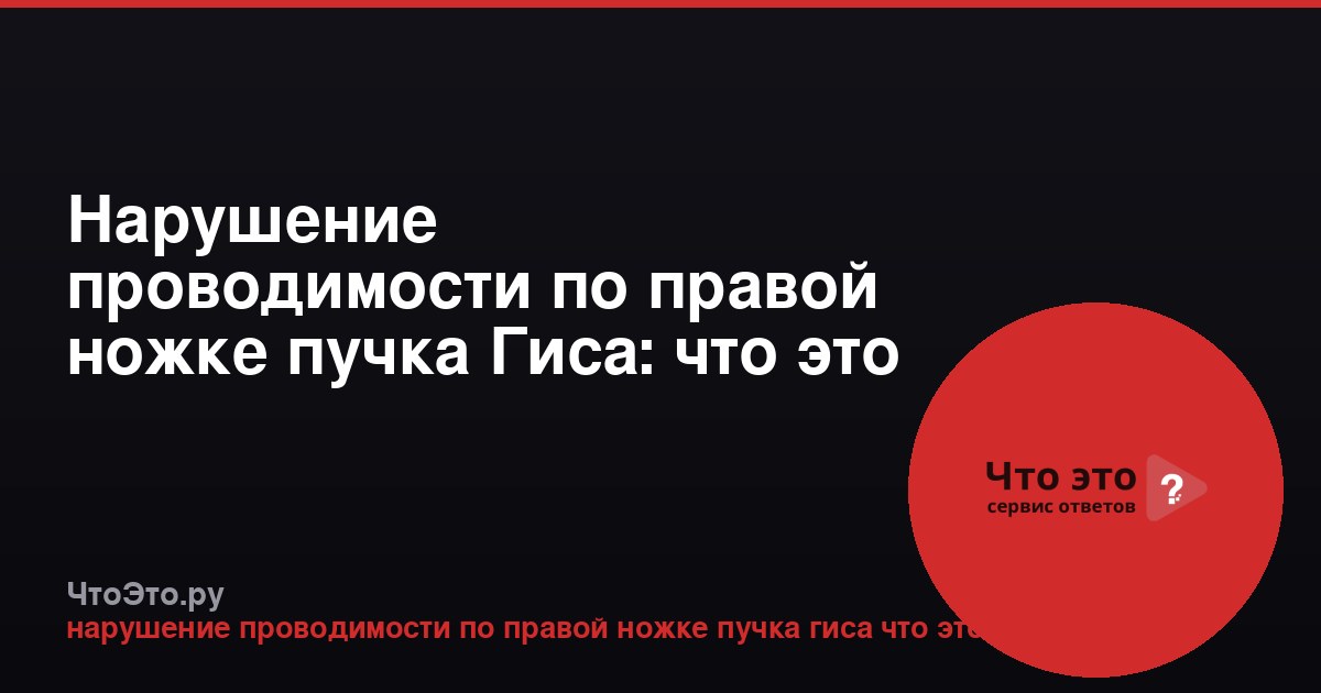 Нарушение проводимости по правой ножке пучка Гиса: что это такое