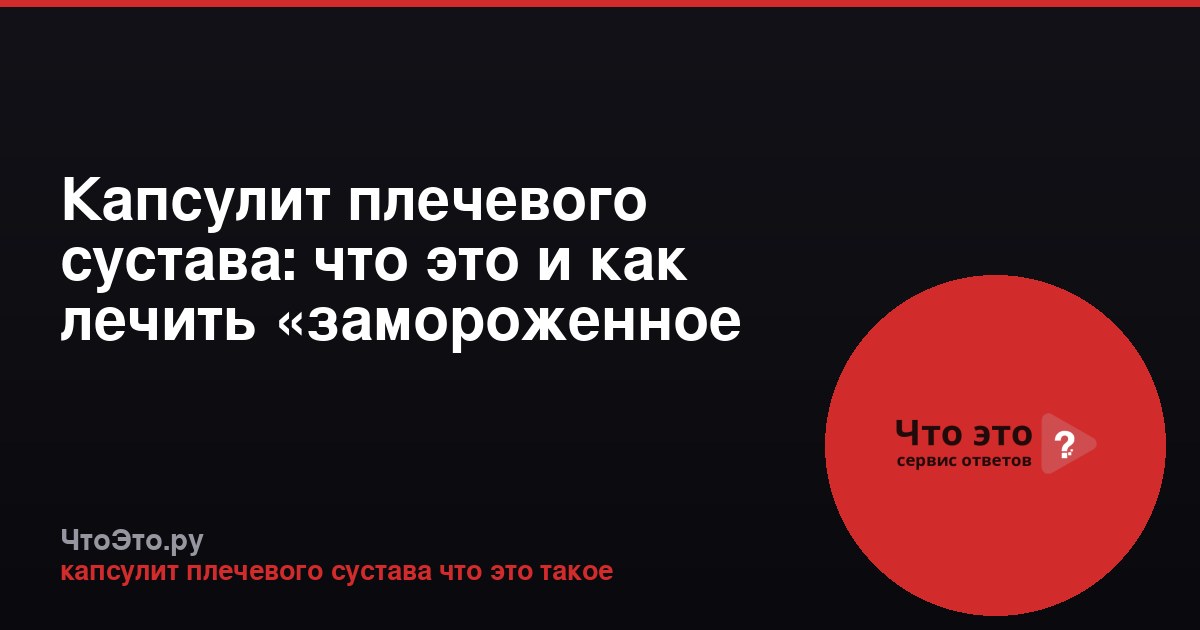 Капсулит плечевого сустава: что это и как лечить «замороженное плечо»