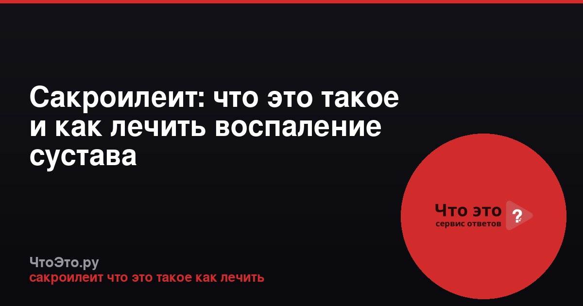 Сакроилеит: что это такое и как лечить воспаление сустава