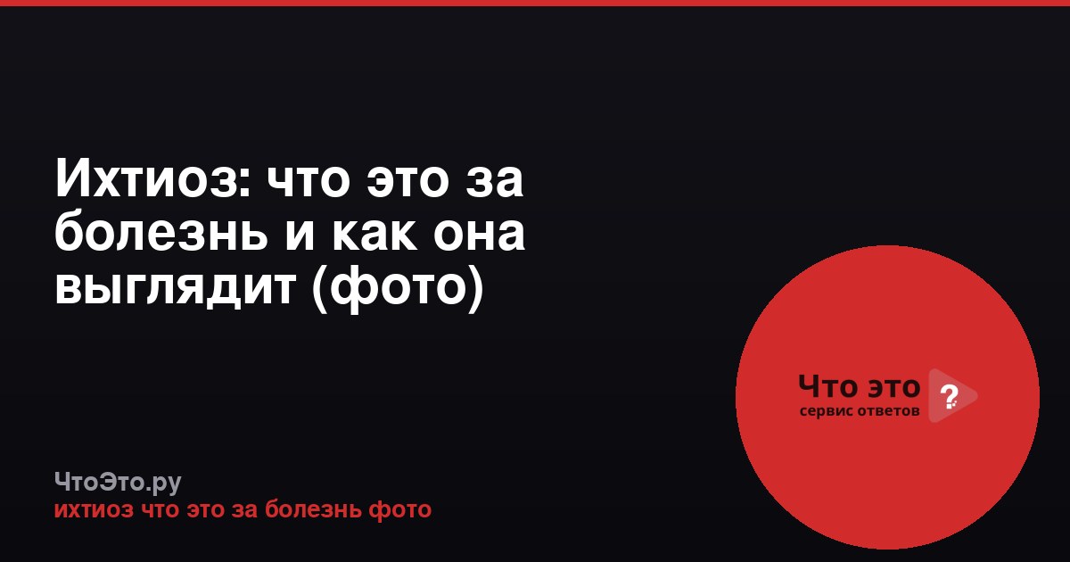 Ихтиоз: что это за болезнь и как она выглядит (фото)