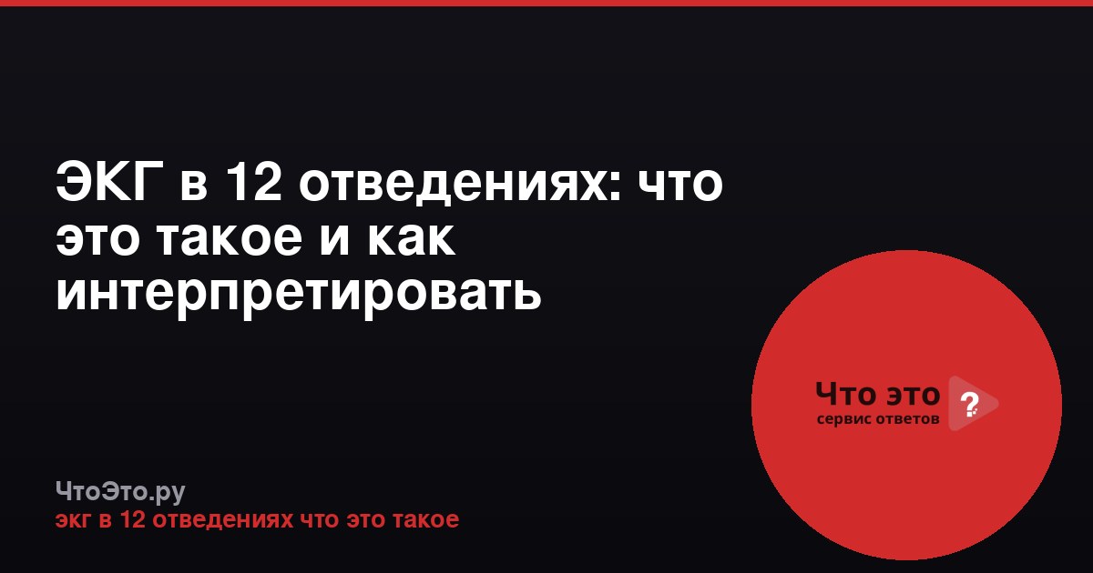ЭКГ в 12 отведениях: что это такое и как интерпретировать