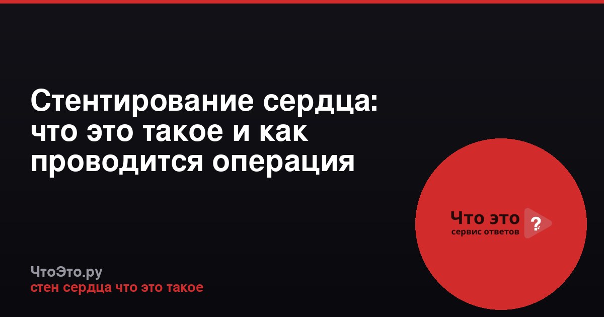 Стентирование сердца: что это такое и как проводится операция
