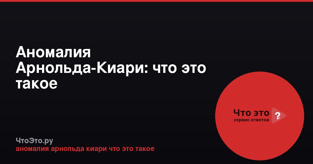 Аномалия Арнольда-Киари: что это такое