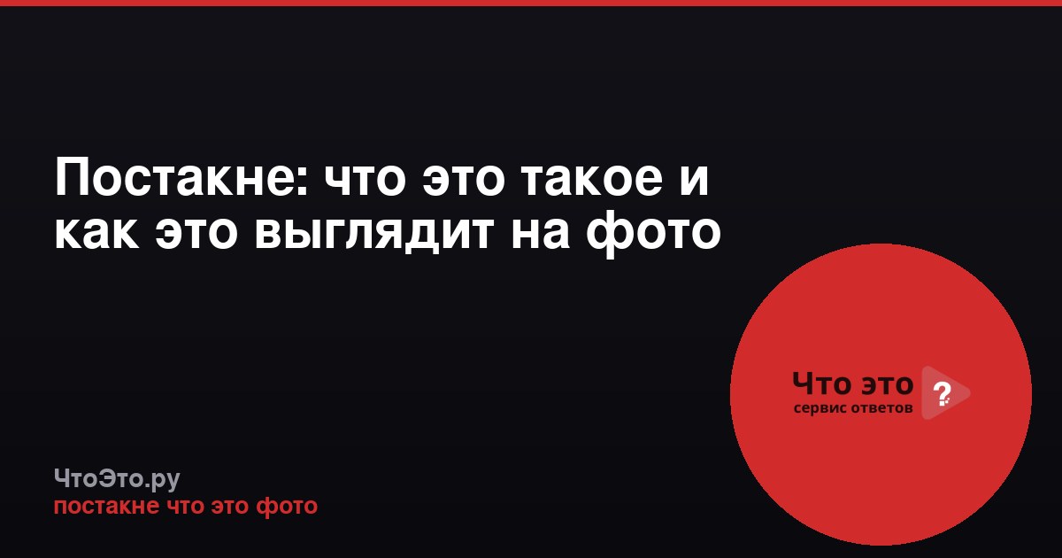 Постакне: что это такое и как это выглядит на фото