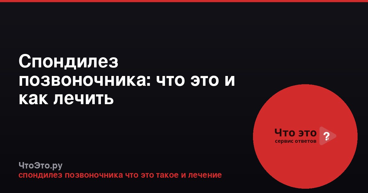 Спондилез позвоночника: что это и как лечить