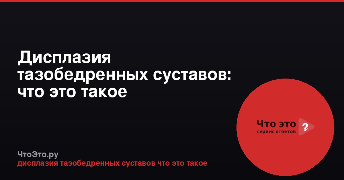 Дисплазия тазобедренных суставов: что это такое