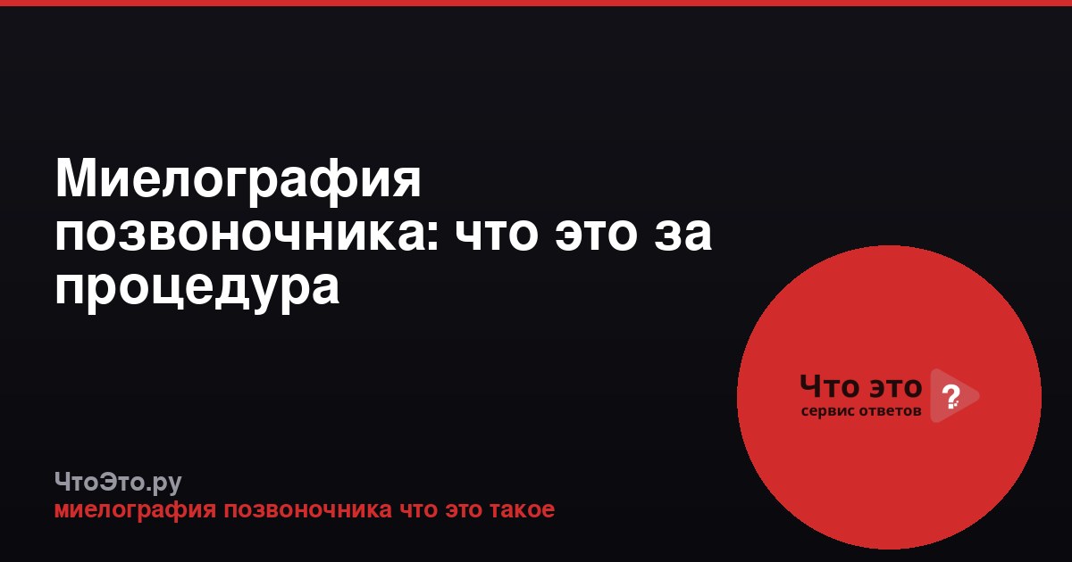 Миелография позвоночника: что это за процедура