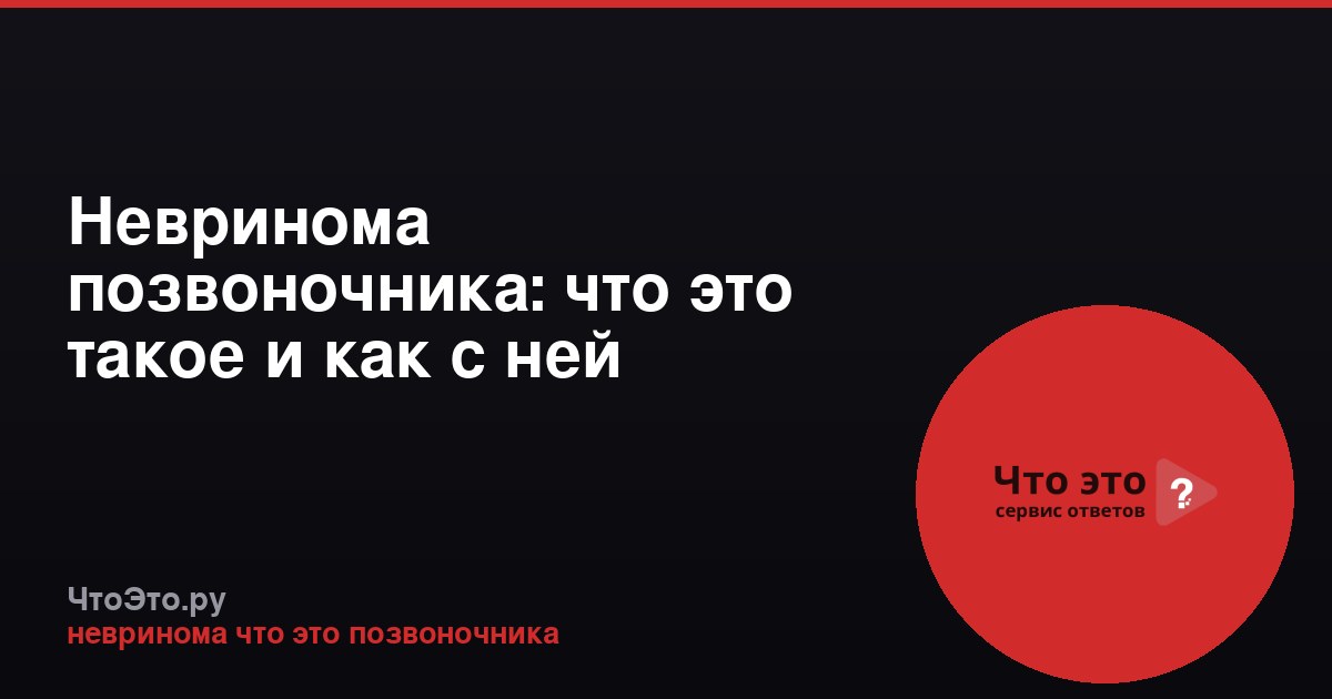Невринома позвоночника: что это такое и как с ней бороться
