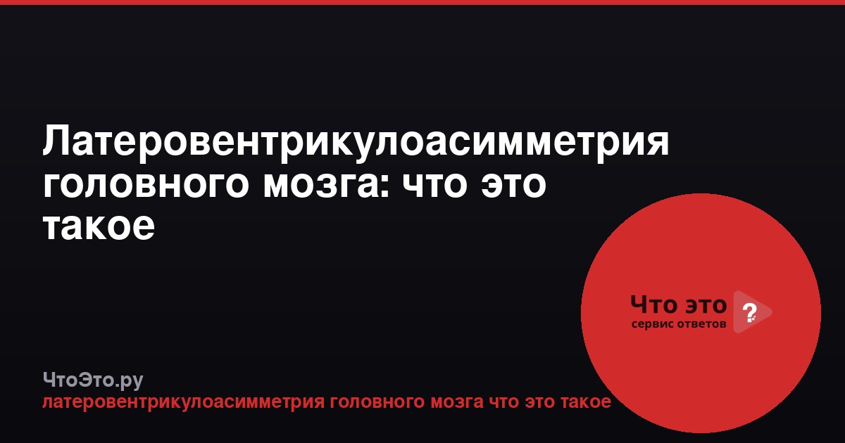 Латеровентрикулоасимметрия головного мозга: что это такое