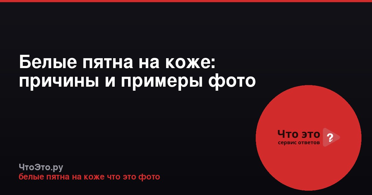Белые пятна на коже: причины и примеры фото