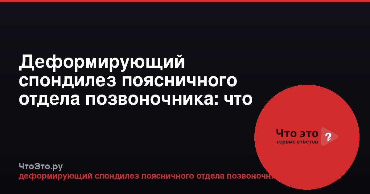 Деформирующий спондилез поясничного отдела позвоночника: что это такое