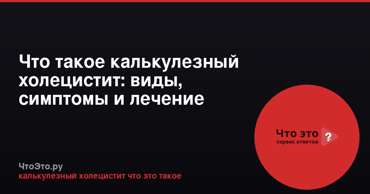 Что такое калькулезный холецистит: виды, симптомы и лечение