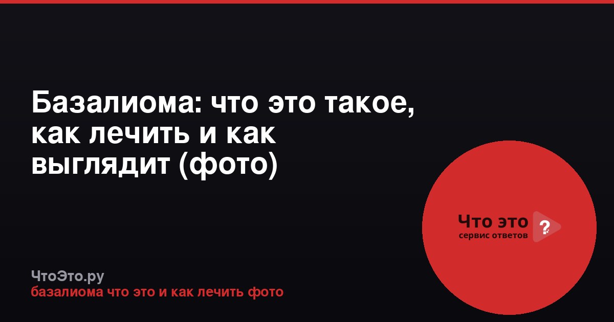 Базалиома: что это такое, как лечить и как выглядит (фото)