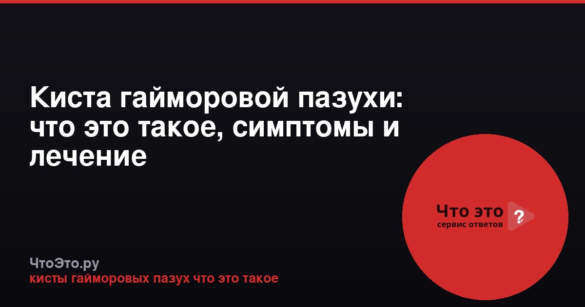 Киста гайморовой пазухи: что это такое, симптомы и лечение