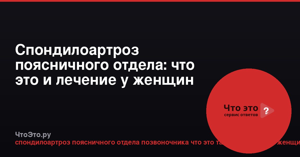 Спондилоартроз поясничного отдела: что это и лечение у женщин после 50