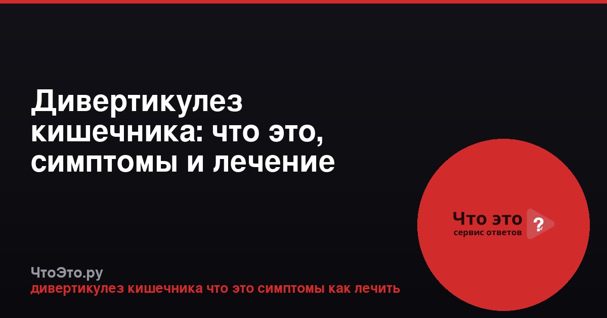 Дивертикулез кишечника: что это, симптомы и лечение