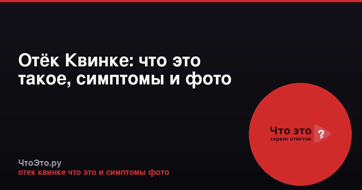 Отёк Квинке: что это такое, симптомы и фото