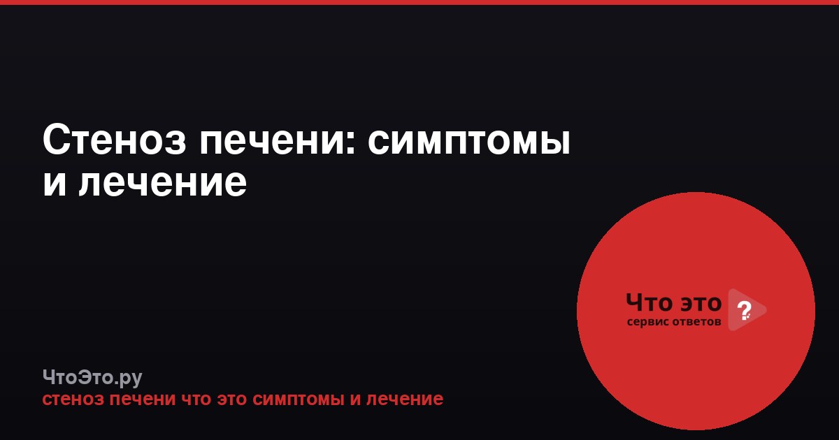Стеноз печени: симптомы и лечение