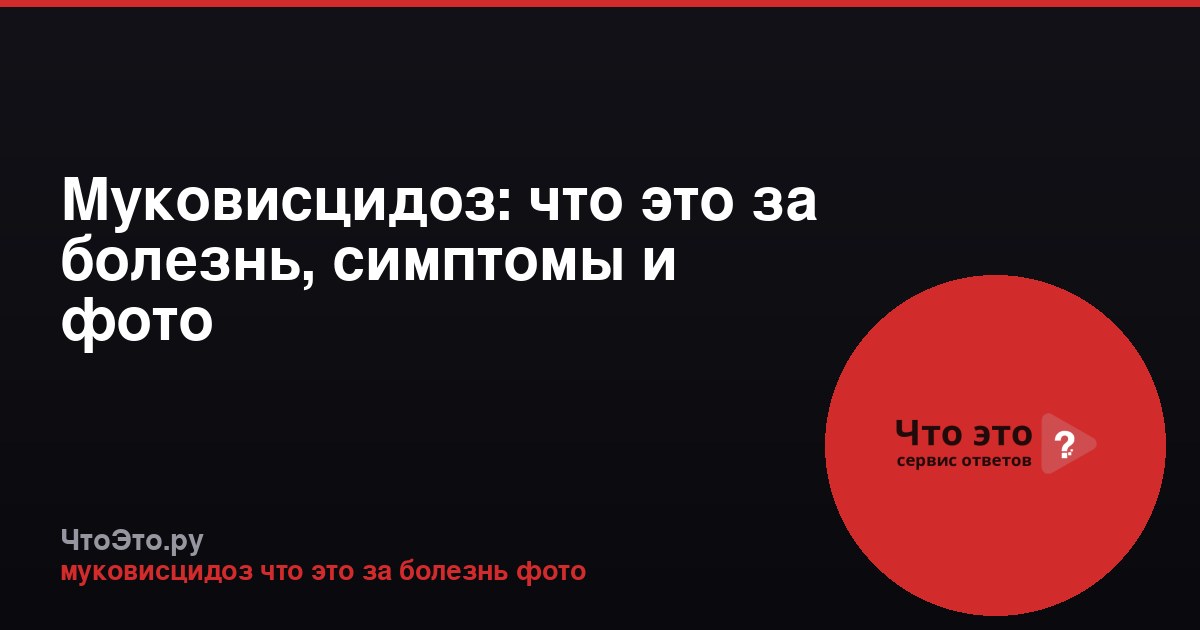 Муковисцидоз: что это за болезнь, симптомы и фото