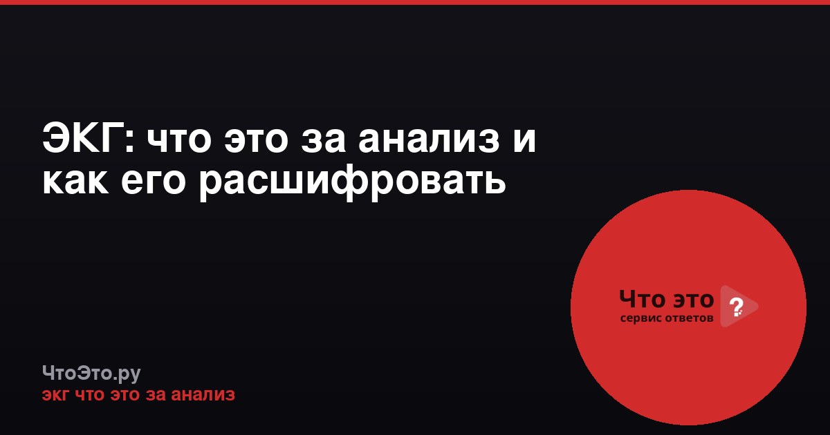 ЭКГ: что это за анализ и как его расшифровать