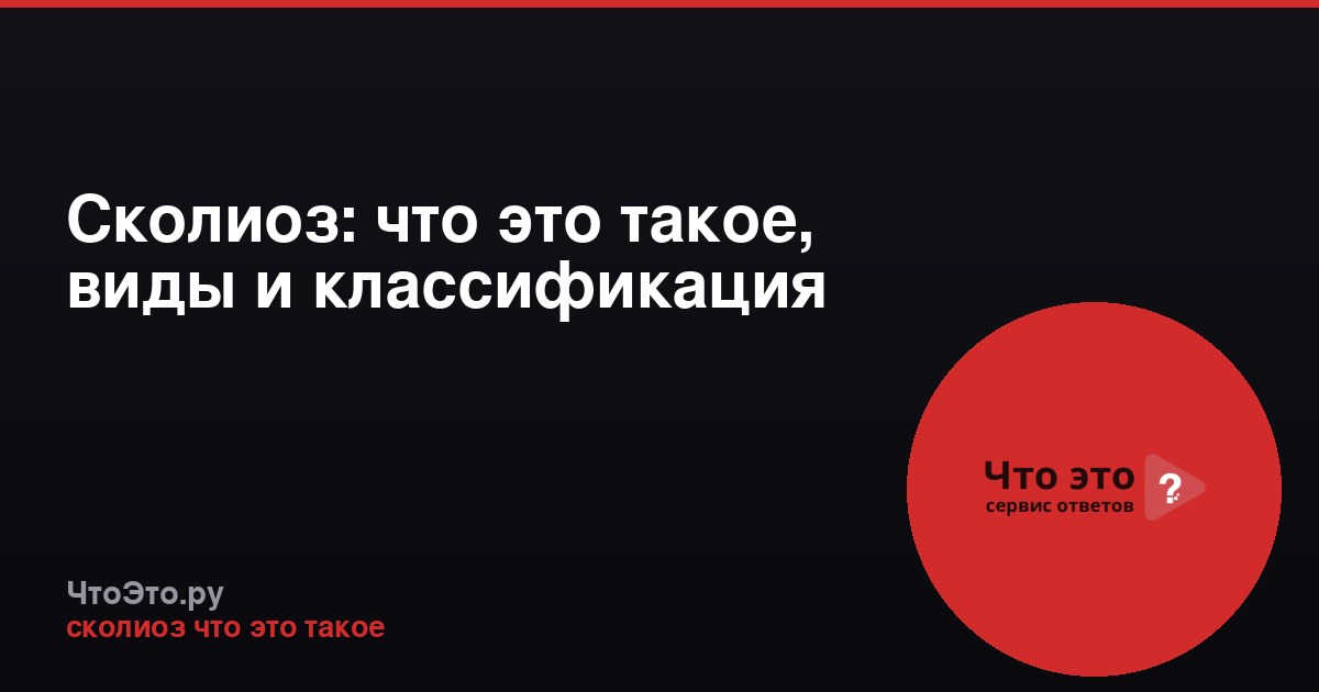 Сколиоз: что это такое, виды и классификация
