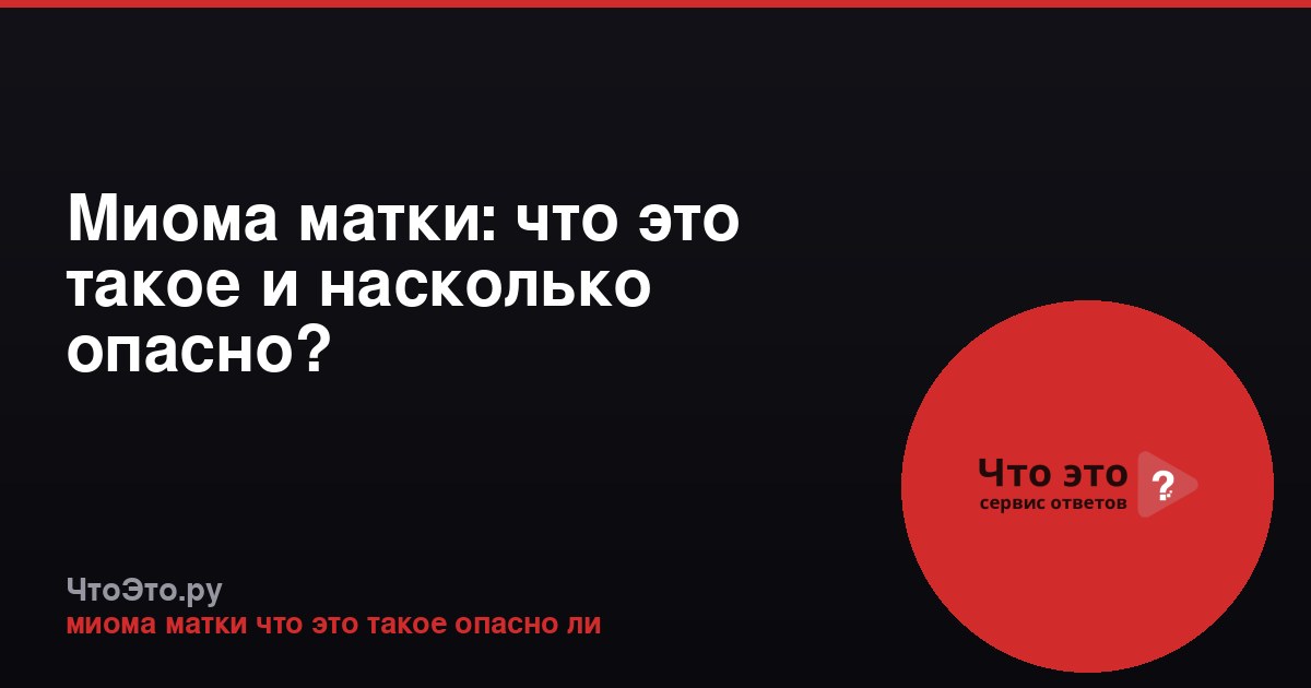 Миома матки: что это такое и насколько опасно?