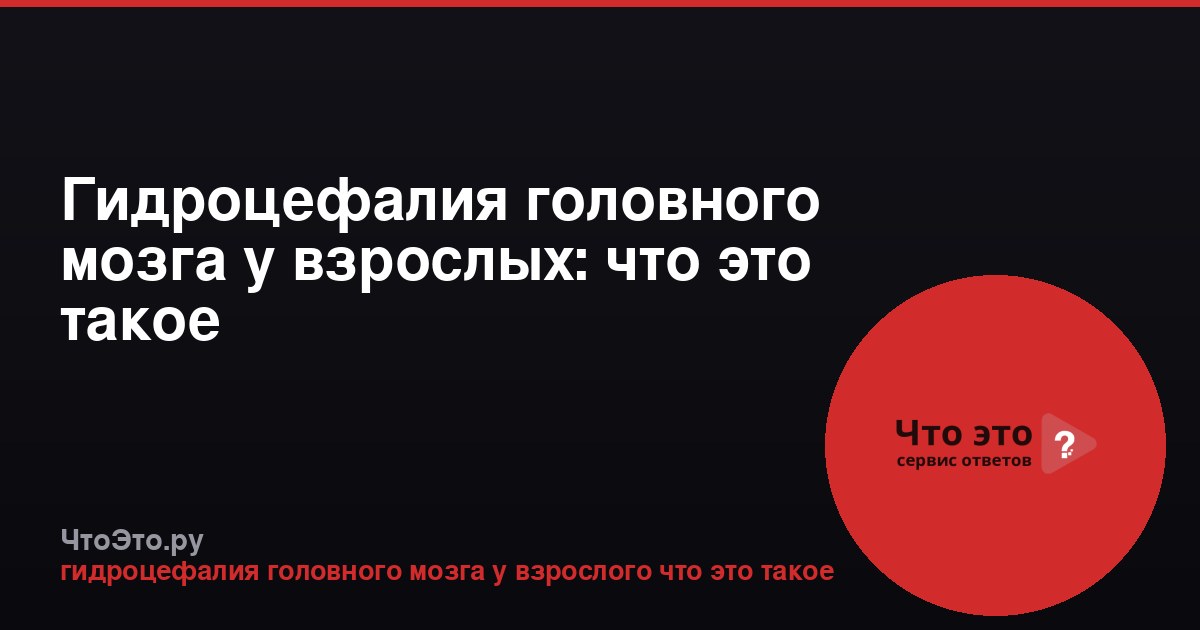 Гидроцефалия головного мозга у взрослых: что это такое