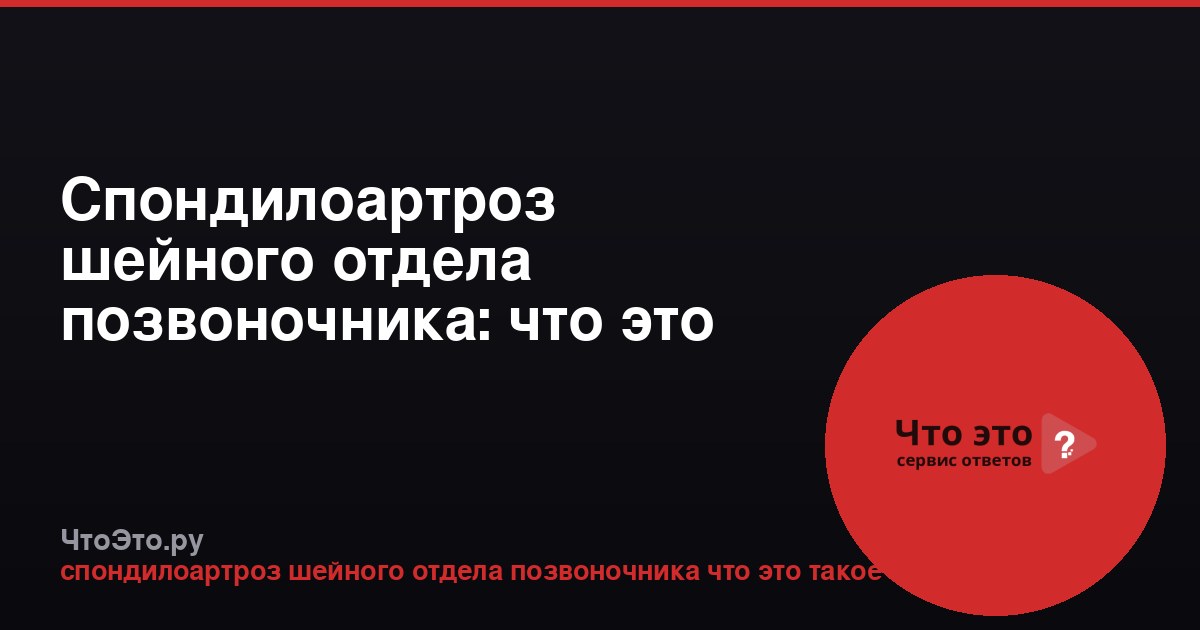 Спондилоартроз шейного отдела позвоночника: что это такое