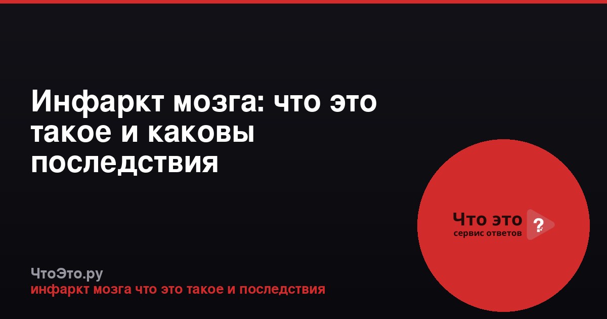 Инфаркт мозга: что это такое и каковы последствия