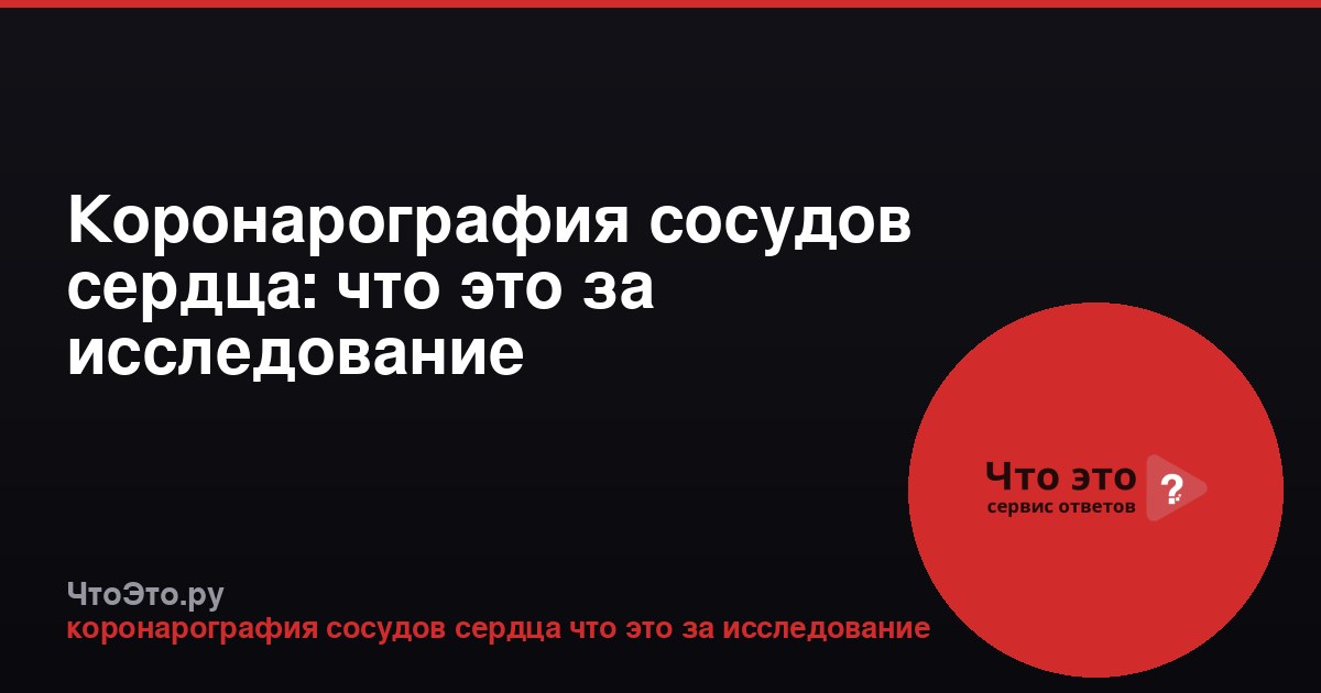 Коронарография сосудов сердца: что это за исследование