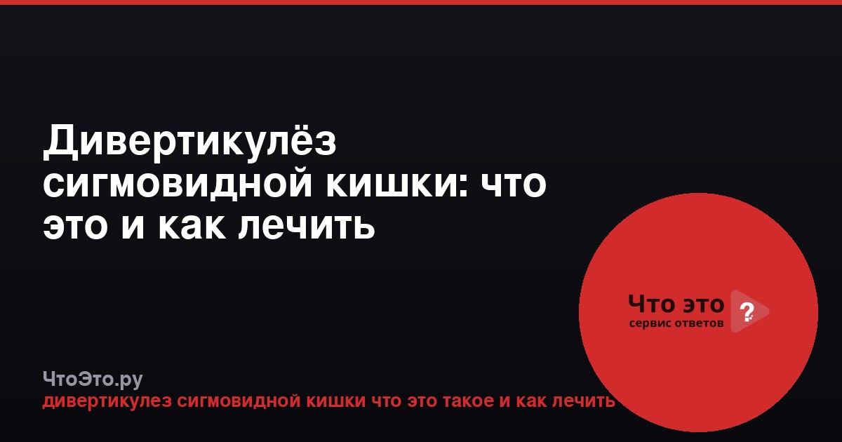 Дивертикулёз сигмовидной кишки: что это и как лечить