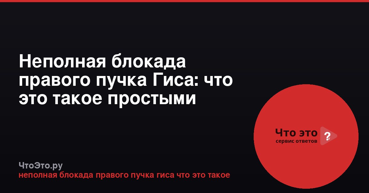 Неполная блокада правого пучка Гиса: что это такое простыми словами