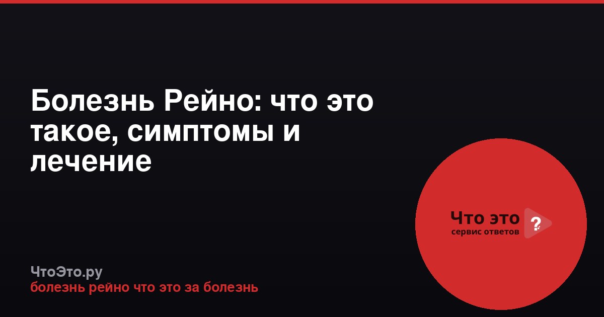 Болезнь Рейно: что это такое, симптомы и лечение