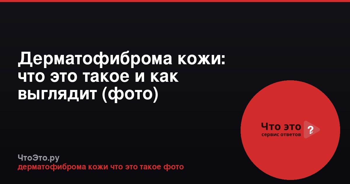 Дерматофиброма кожи: что это такое и как выглядит (фото)