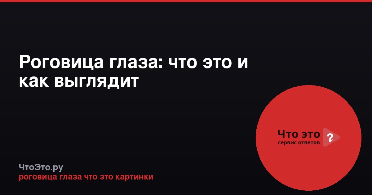 Роговица глаза: что это и как выглядит