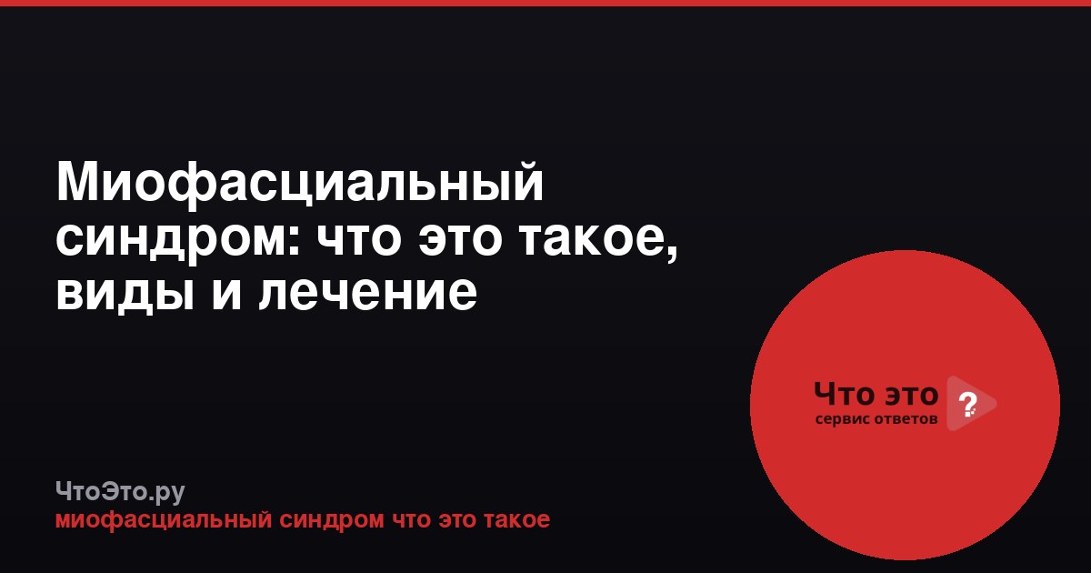 Миофасциальный синдром: что это такое, виды и лечение