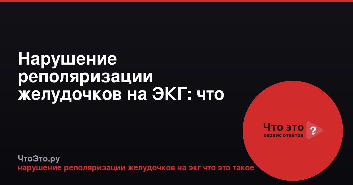 Нарушение реполяризации желудочков на ЭКГ: что это значит