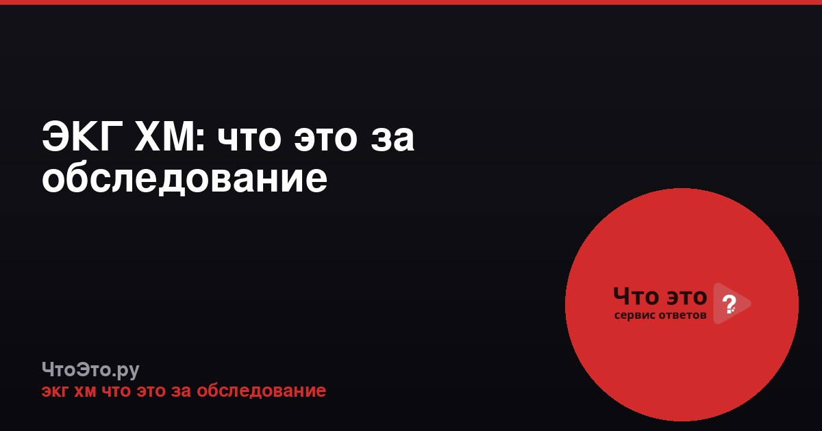 ЭКГ ХМ: что это за обследование
