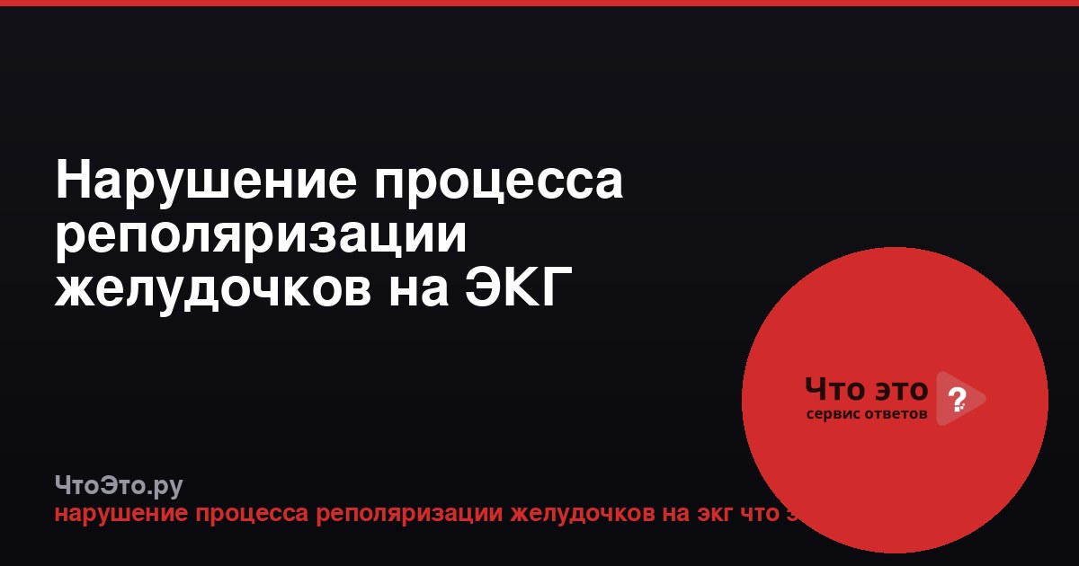 Нарушение процесса реполяризации желудочков на ЭКГ