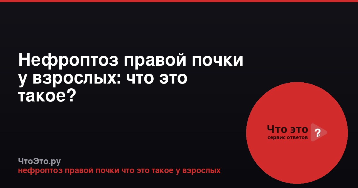Нефроптоз правой почки у взрослых: что это такое?