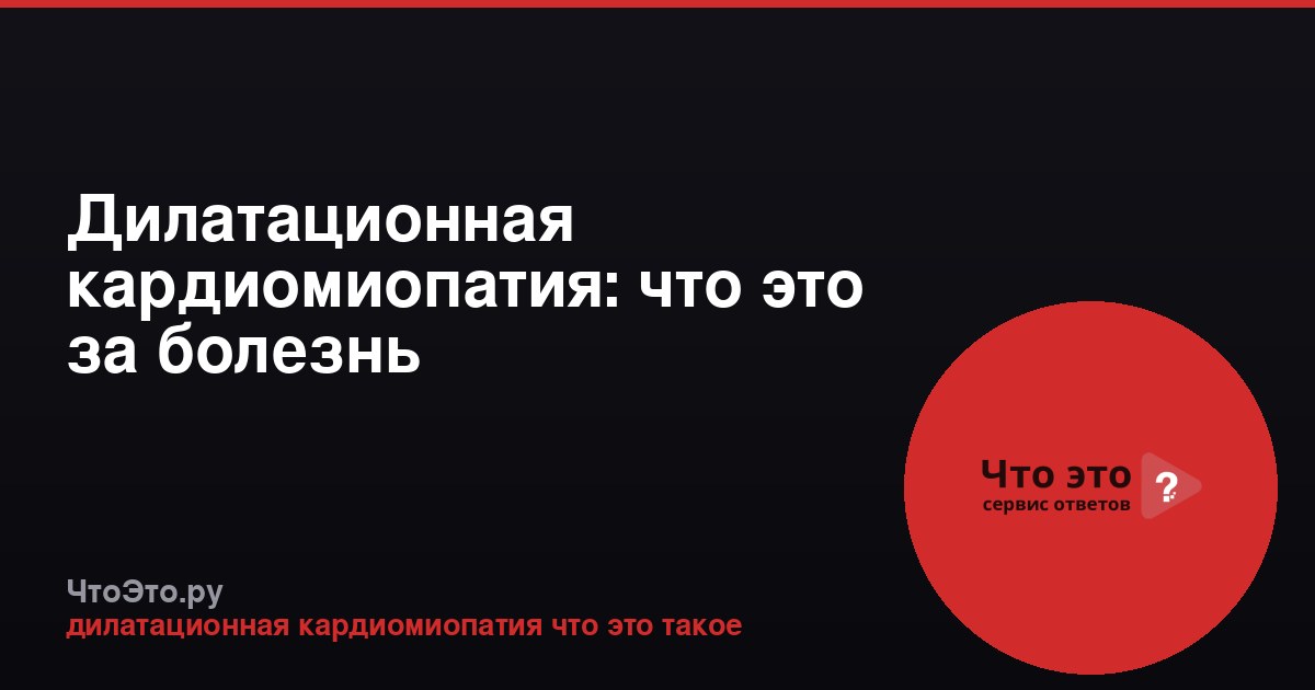 Дилатационная кардиомиопатия: что это за болезнь