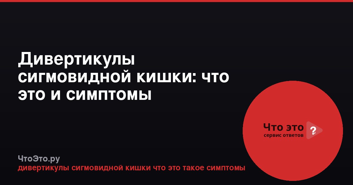 Дивертикулы сигмовидной кишки: что это и симптомы